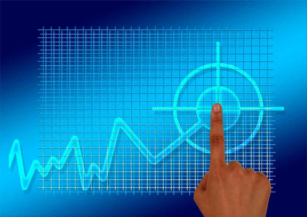 Bitcoin Kurs Analyse – Das andert alles, 18% Kursgewinn voraus?